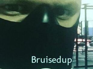 Bruisedup