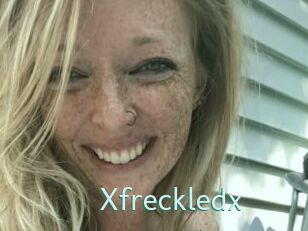 Xfreckledx